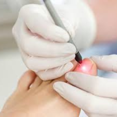 A laserterapia, também conhecida como terapia a laser de baixa intensidade (TLBI), é um método terapêutico inovador que utiliza a luz laser para promover a cura e o bem-estar do corpo. Essa luz, aplicada em doses precisas, possui propriedades biomoduladoras que estimulam o metabolismo celular, gerando diversos benefícios para o organismo.