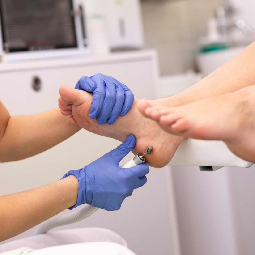 A podologia preventiva é uma abordagem focada em cuidados contínuos e medidas preventivas para garantir a saúde dos pés. Ela identifica e trata problemas nas fases iniciais, prevenindo complicações e promovendo uma vida ativa e confortável.